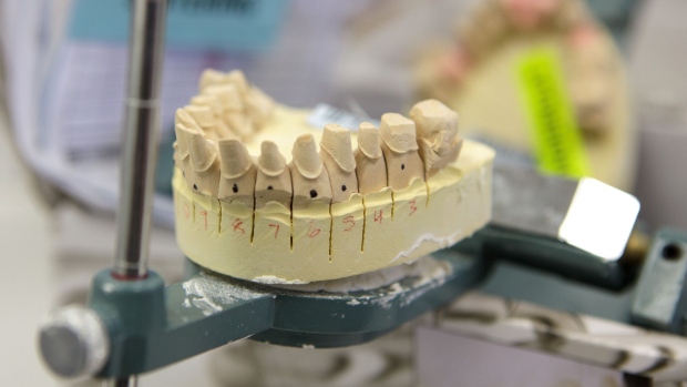 A dental mold sits on a machine at the Glidewell Laboratories facility in Newport Beach, California, U.S., on Friday, April 14, 2017. Implants, crowns and bridges made in places like China and Mexico compose as much as 40 percent of the $8.5 billion U.S. market for dental restorations. Overall, imports account for 30 percent of the U.S. medical-device market, and reached nearly $44 billion in 2016, according to BMI Research, a division of the Fitch Group. Photographer: Troy Harvey/Bloomberg